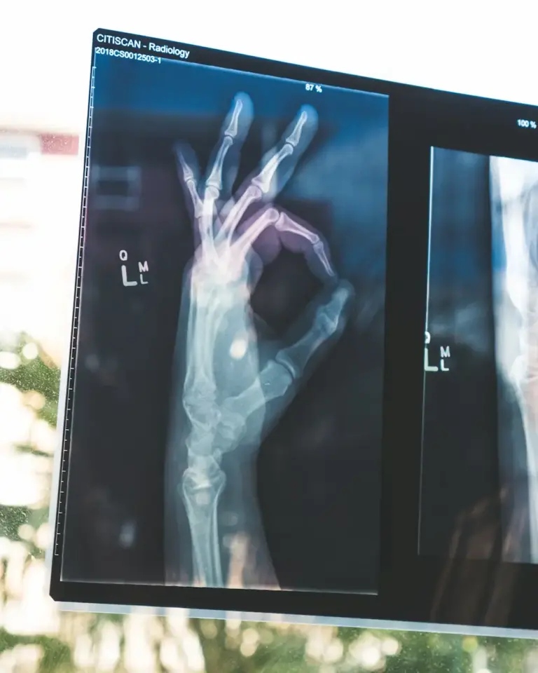 الذكاء الاصطناعي في الطب